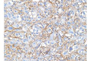 Immunohistochemistry (IHC) image for anti-CD44 (CD44) (AA 692-742) antibody (ABIN7453578)