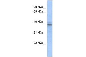 WB Suggested Anti-ZNF625 Antibody Titration:  0. (ZNF625 anticorps  (N-Term))