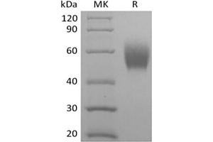Western Blotting (WB) image for Signal-Regulatory Protein alpha (SIRPA) (Active) protein (His tag) (ABIN7321029)