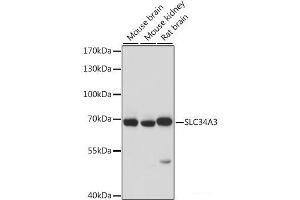 Western blot analysis of extracts of various cell lines using SLC34A3 Polyclonal Antibody at dilution of 1:1000. (SLC34A3 anticorps)