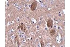 Immunohistochemistry of CDIP in mouse brain tissue with CDIP antibody at 2.
