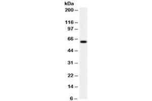 Western blot testing of HeLa cell lysate with HSP60 antibody (clone LK2). (HSPD1 anticorps)