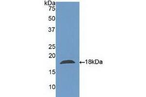 Detection of Recombinant CLC, Human using Polyclonal Antibody to Charcot Leyden Crystal Protein (CLC) (Galectin 10 anticorps  (AA 2-142))