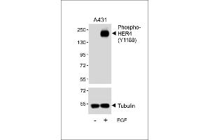 Western blot analysis of lysates from A431 cell line, untreated or treated with EGF, 100 ng/mL, using Phospho-HER4 Antibody (upper) or tubulin (lower).