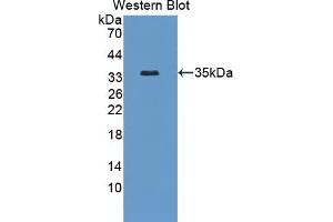 Detection of Recombinant PLVAP, Human using Polyclonal Antibody to Plasmalemma Vesicle Associated Protein (PLVAP)