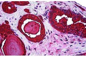 Anti-KLK3 / PSA antibody IHC staining of human prostate. (Prostate Specific Antigen anticorps)