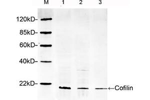 Lane 1: Hela lysateLane 2: HEK293 lysateLane 3: NIH/3T3 lysateWestern blot analysis cell lysates using 1 µg/mL Rabbit Anti-Cofilin Polyclonal Antibody (ABIN398791) The signal was developed with IRDyeTM 800 Conjugated Goat Anti-Rabbit IgG. (Cofilin anticorps  (AA 100-150))