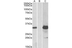 HEK293 lysate (10ug protein in RIPA buffer) overexpressing Human KCTD11 with DYKDDDDK tag probed with ABIN2563535 (1. (KCTD11 anticorps  (Internal Region))