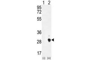 Western blot analysis of CSH1 (arrow) using rabbit polyclonal CSH1 Antibody (C-term) .