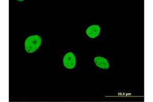 Immunofluorescence of monoclonal antibody to NOL4 on HeLa cell. (NOL4 anticorps  (AA 425-524))