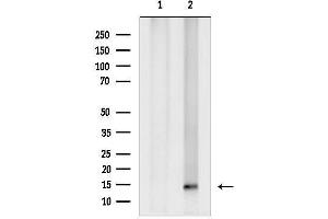 Western blot analysis of lysates from VERO cells, using SUMO4 Antibody.