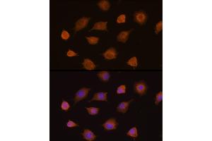 anti-Pyruvate Kinase M1/2 (PKM) (AA 11-221) antibody