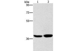 Western Blot analysis of Human fetal brain tissue and 231 cell using CAB39L Polyclonal Antibody at dilution of 1:400 (CAB39L anticorps)