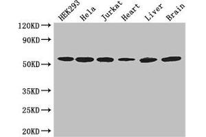 Western Blot Positive WB detected in: HEK293 whole cell lysate, Hela whole cell lysate, Jurkat whole cell lysate, Mouse heart tissue, Mouse liver tissue, Mouse brain tissue All lanes: ARIH2 antibody at 3 μg/mL Secondary Goat polyclonal to rabbit IgG at 1/50000 dilution Predicted band size: 58 kDa Observed band size: 58 kDa (ARIH2 anticorps  (AA 43-360))