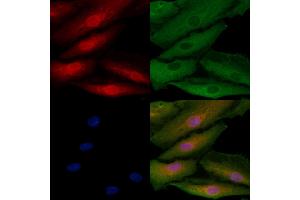 ABIN6260082 and ABIN6272540 staining  cells by IF/ICC. (ASPM anticorps  (Internal Region))