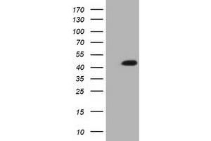 Western Blotting (WB) image for anti-Isovaleryl-CoA Dehydrogenase (IVD) antibody (ABIN1498919) (IVD anticorps)
