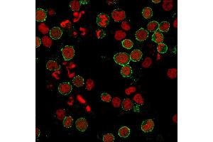Immunofluorescence staining of MOLT-4 cells using CD6 Rabbit Recombinant Monoclonal Antibody (C6/2884R) followed by goat anti-rabbit IgG conjugated to CF488 (green).