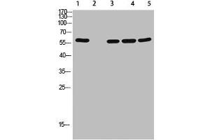 Western Blot analysis of 1,mouse-lung 2,mouse-spleen 3,mouse-kidney 4,mouse-heart 5,293 cells using primary antibody diluted at 1:500(4 °C overnight). (AVPR2 anticorps  (AA 1-50))