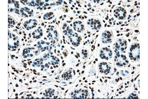 Immunohistochemical staining of paraffin-embedded breast tissue using anti-TYRO3 mouse monoclonal antibody. (TYRO3 anticorps)