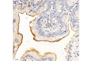 Immunohistochemistry of paraffin embedded mouse duodenum using ADCY4 (ABIN7072959) at dilution of 1: 700 (400x lens) (ADCY4 anticorps)