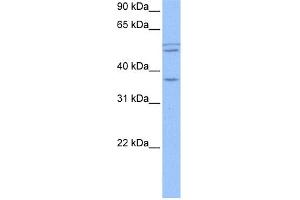 WB Suggested Anti-CCDC78 Antibody Titration: 0. (CCDC78 anticorps  (Middle Region))