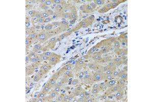 Immunohistochemistry of paraffin-embedded human liver injury using UGT2B10 antibody at dilution of 1:100 (x40 lens). (UGT2B10 anticorps)