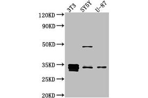 Western Blot Positive WB detected in: NIH/3T3 whole cell lysate, SH-SY5Y whole cell lysate, U-87 whole cell lysate All lanes: Cyclin D1 antibody at 1:1000 Secondary Goat polyclonal to rabbit IgG at 1/50000 dilution Predicted band size: 34 kDa Observed band size: 34 kDa (Recombinant Cyclin D1 anticorps)
