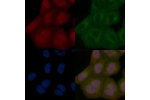 USP21 Mouse Monoclonal Antibody staining Hela cells by IF/ICC. (USP21 anticorps)