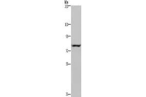 Gel: 6 % SDS-PAGE, Lysate: 40 μg, Lane: Hela cells, Primary antibody: ABIN7130441(NOC2L Antibody) at dilution 1/200, Secondary antibody: Goat anti rabbit IgG at 1/8000 dilution, Exposure time: 5 seconds (NOC2L anticorps)