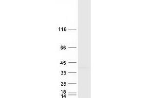 Validation with Western Blot