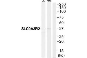 Western blot analysis of extracts from JK cells and K562 cells, using SLC9A3R2 antibody. (SLC9A3R2 anticorps  (N-Term))