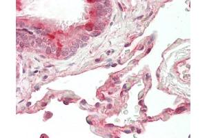 Human Lung: Formalin-Fixed, Paraffin-Embedded (FFPE).