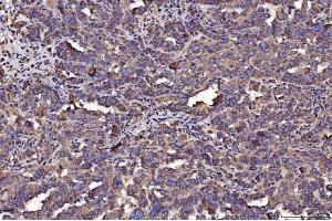 IHC analysis of PDIA6 using anti-PDIA6 antibody (ABIN7600554). (PDIA6 anticorps  (AA 20-440))