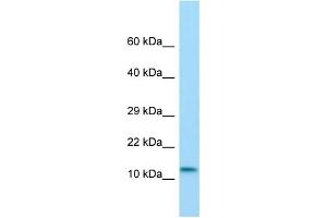 Host: Rabbit Target Name: RGD1560833 Sample Type: Rat Pancreas lysates Antibody Dilution: 1. (MKL2 anticorps  (N-Term))