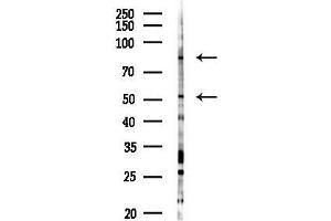 anti-Phosphoinositide 3 Kinase, p85/p55 (PI3K p85/p55) (pTyr199), (pTyr458), (pTyr467) antibody