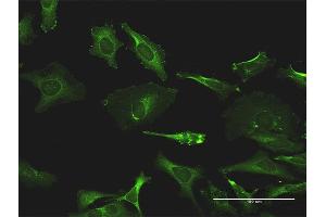 Immunofluorescence of monoclonal antibody to TXK on HeLa cell.