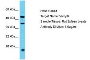 Image no. 1 for anti-Vesicle-Associated Membrane Protein 8 (Endobrevin) (VAMP8) (AA 40-89) antibody (ABIN6750424) (VAMP8 anticorps  (AA 40-89))