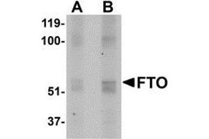 Western blot analysis of FTO in human uterus tissue lysate with AP30350PU-N FTO antibody at (A) 1 and (B) 2 μg/ml. (FTO anticorps  (N-Term))