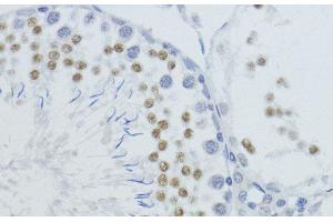 Immunohistochemistry of paraffin-embedded Rat testis using MonoMethyl-Histone H4-K20 Polyclonal Antibody at dilution of 1:200 (40x lens).
