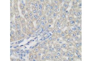 Immunohistochemistry of paraffin-embedded Rat liver using METTL7A Polyclonal Antibody at dilution of 1:200 (40x lens). (METTL7A anticorps)