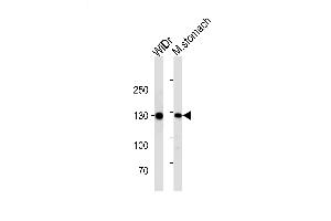 Lane 1: WiDr, Lane 2: mouse stomach lysate at 20 µg per lane, probed with bsm-51214M CDH1 (813CT11. (E-cadherin anticorps)