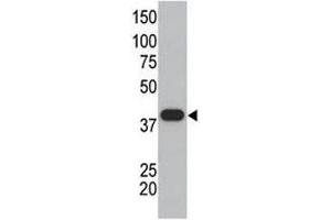 SUMO polyclonal antibody used in western blot to detect GST-SUMO1 fusion protein. (SUMO1 anticorps  (AA 55-86))