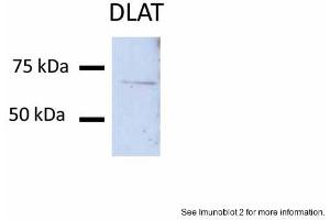 Sample Type: Huh7 lysate (50ug)Primary Antibody Dilution: 1:200Image Submitted By: Partha KasturiUniversity of Kansas Medical Center (DLAT anticorps  (N-Term))