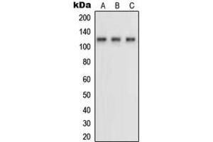 Western blot analysis of Neuropilin 1 expression in HUVEC (A), MDAMB231 (B), COS7 (C) whole cell lysates. (Neuropilin 1 anticorps  (Center))