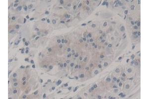 DAB staining on IHC-P; Samples: Human Stomach Tissue (Nestin anticorps  (AA 178-399))