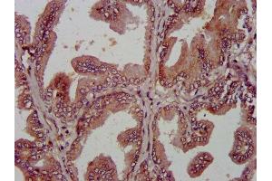 IHC image of ABIN7144036 diluted at 1:800 and staining in paraffin-embedded human prostate tissue performed on a Leica BondTM system. (AMIGO2 anticorps  (AA 420-522))