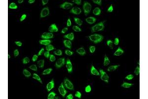Immunofluorescence analysis of A-549 cells using HSD3B2 antibody (ABIN6131145, ABIN6142018, ABIN6142019 and ABIN6218943). (HSD3B2 anticorps  (AA 1-287))