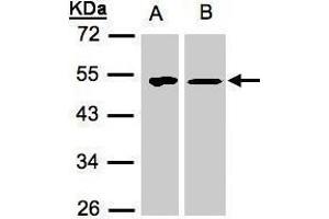 WB Image Sample(30 μg of whole cell lysate) A:293T B:H1299 10% SDS PAGE antibody diluted at 1:1500 (TUFM anticorps)