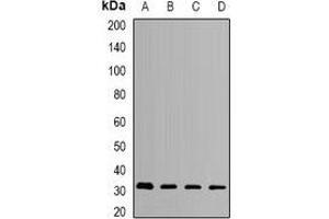 Western blot analysis of HMGCL expression in SKOV3 (A), MCF7 (B), mouse liver (C), mouse kidney (D) whole cell lysates. (HMGCL anticorps)