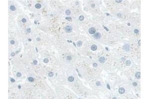 Detection of NADK in Human Liver Tissue using Polyclonal Antibody to NAD Kinase (NADK) (NADK anticorps  (AA 187-426))